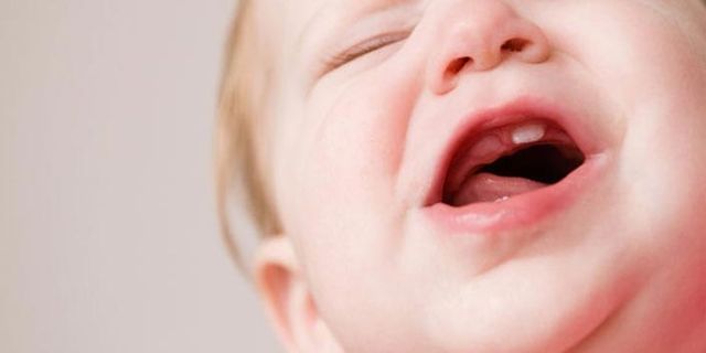 Bebeklerde diş çıkarma serüveni