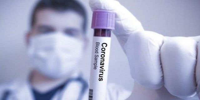 Koronavirüs Değişti! 11 Gün Sonra Bulaşamıyor